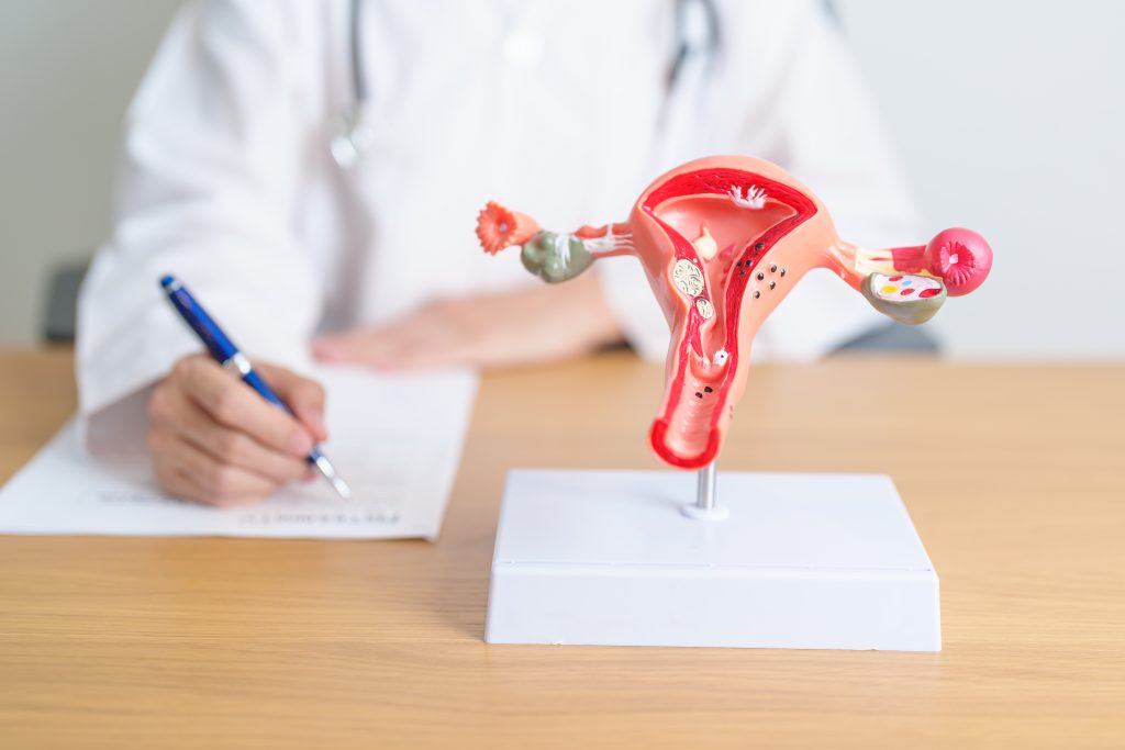 Doctor with Uterus and Ovaries anatomy model