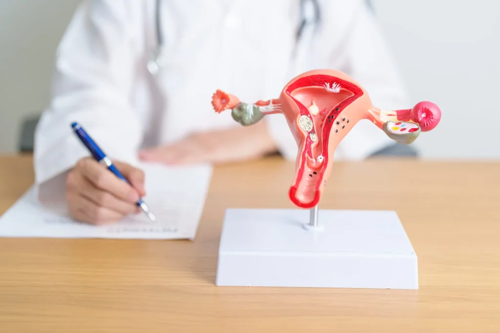 Polycystic Ovary Syndrome (PCOS) and endometriosis