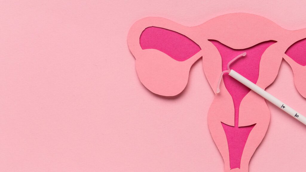 IUD insertion