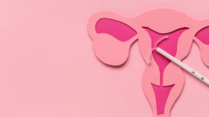 IUD insertion