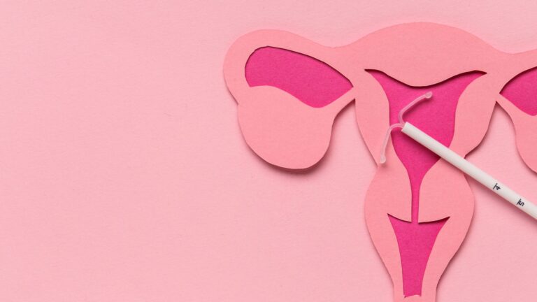 IUD insertion