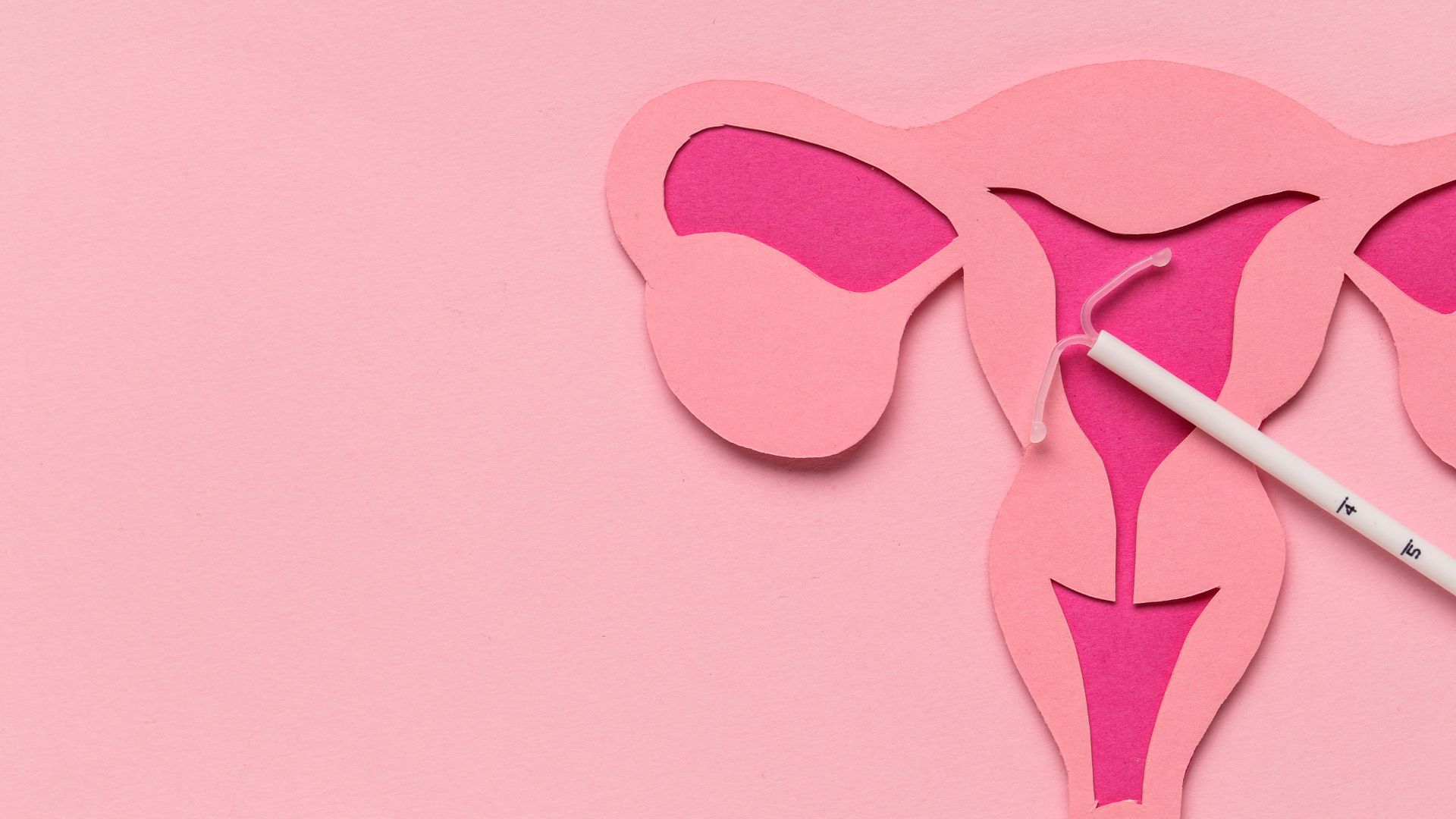 IUD insertion